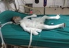 Hà Nội: Bé trai 6 tuổi bị bố dượng tẩm xăng đốt đã qua đời sáng nay