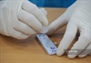 Thêm 24 ca nhiễm SARS-CoV-2 mới, 17 ca ghi nhận tại Bệnh viện Phổi Hà Nội
